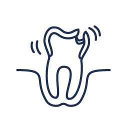 Restorative Dentistry for fractured and unstable teeth in Montrose, CO